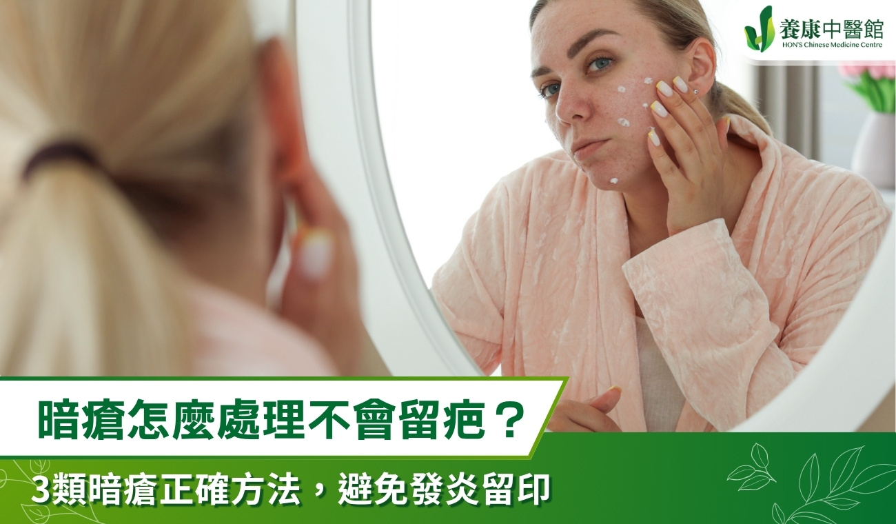 如何處理暗瘡才不留疤？3類暗瘡處理方法，有效避免發炎留印