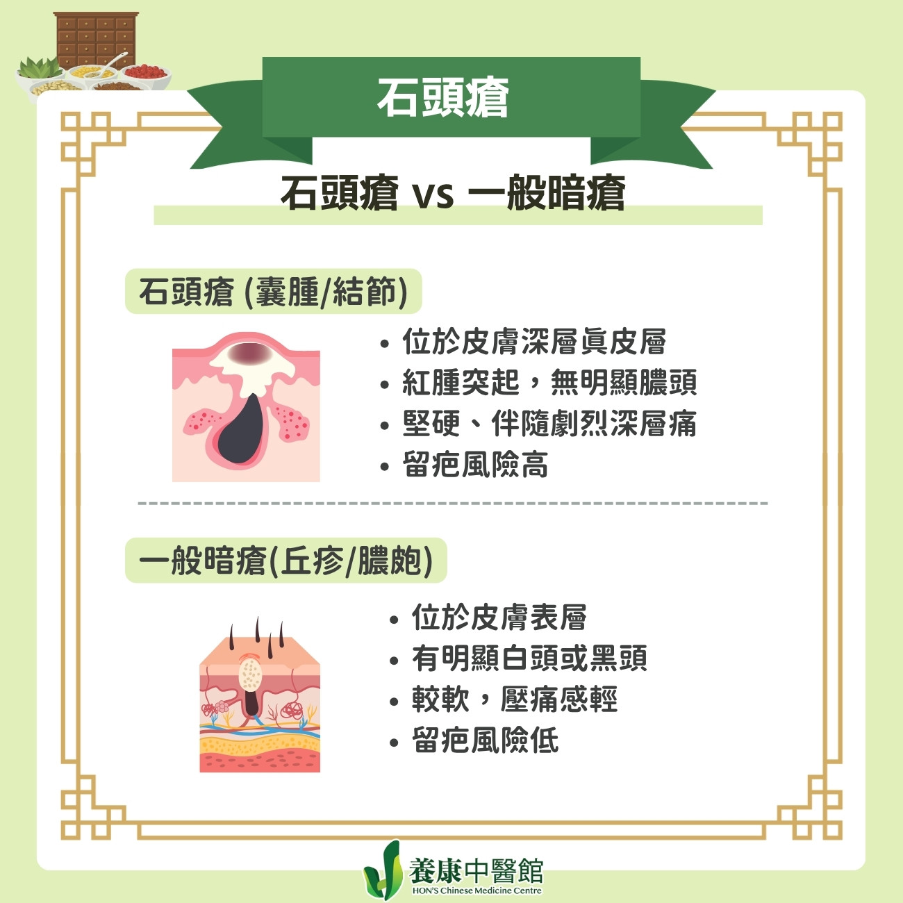 石頭瘡同普通暗瘡，到底有咩不同？
